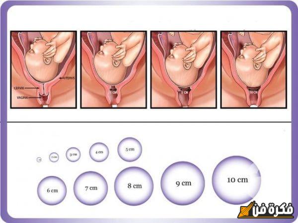 إذا فتح الرحم 4 سم متى تكون الولادة؟ اكتشف السر وراء توقيت لحظة الانتظار الحاسمة!